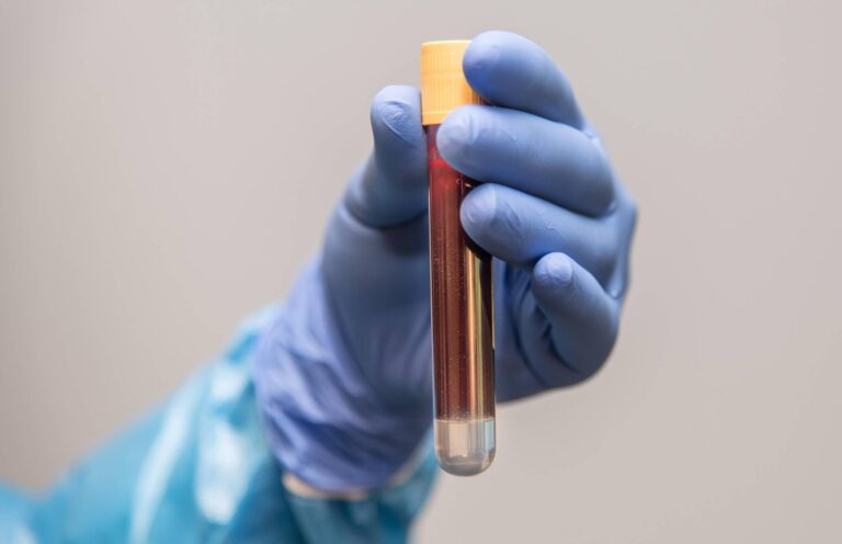 Eine Blutprobe in einem Reagenzglas auf dem Titelbild des Beitrags "Blutwerte & Blutbild für Sportler".